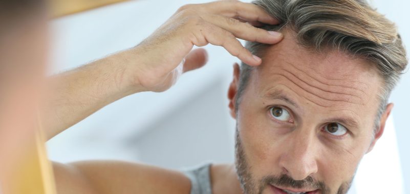 Mann mit Geheimratsecken, der in den Spiegel schaut, symbolisiert Haarausfall bei Männern